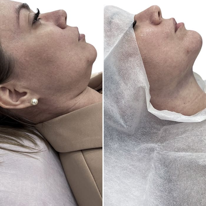 novo-resultados-dr-jhony-12