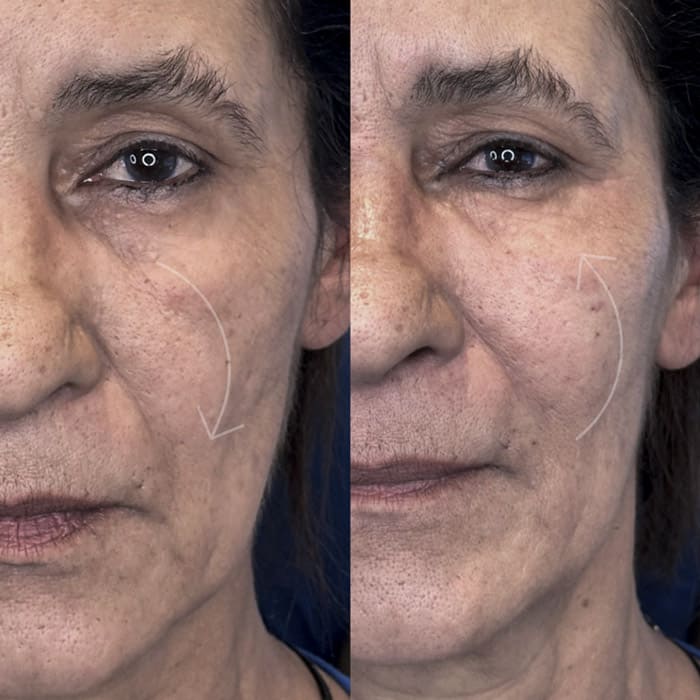 novo-resultados-dr-jhony-13