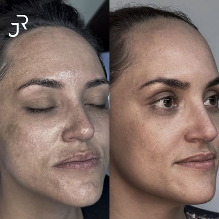 novo-resultados-dr-jhony-14