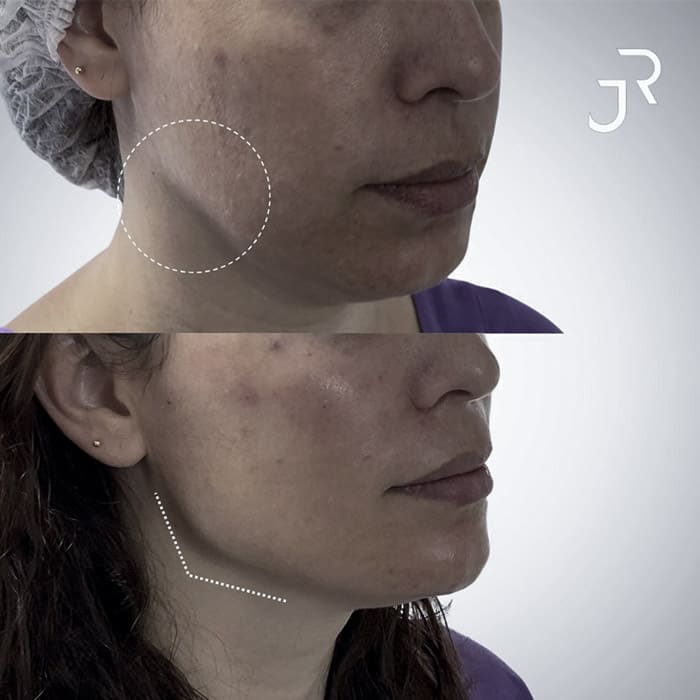 novo-resultados-dr-jhony-15