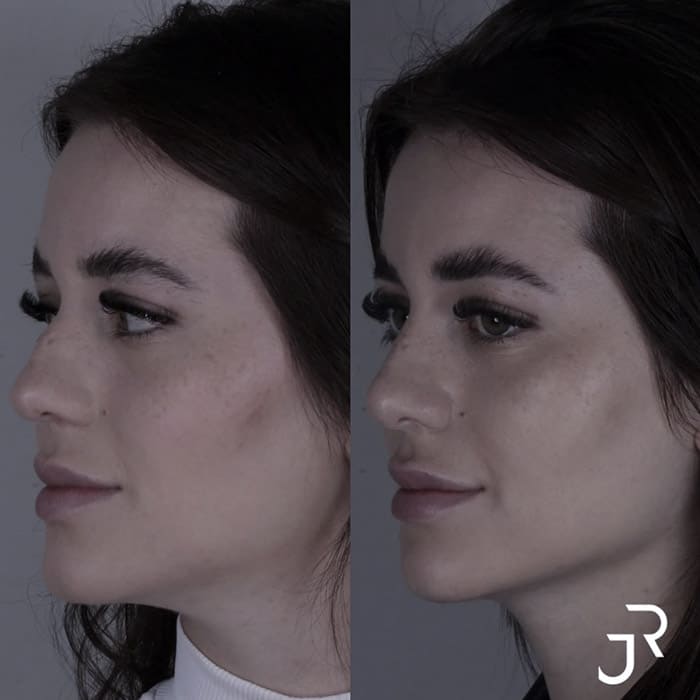 novo-resultados-dr-jhony-16