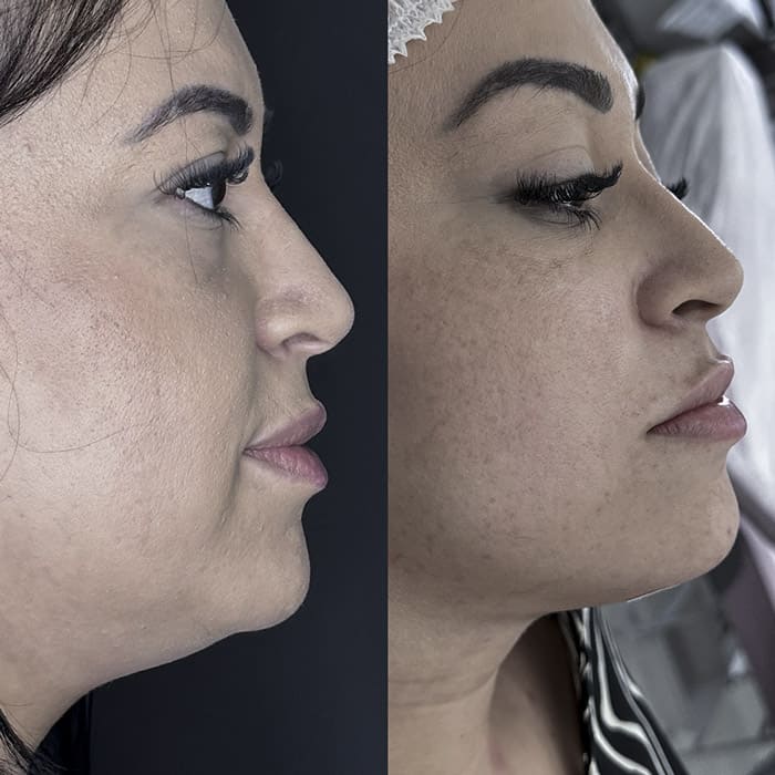 novo-resultados-dr-jhony-17