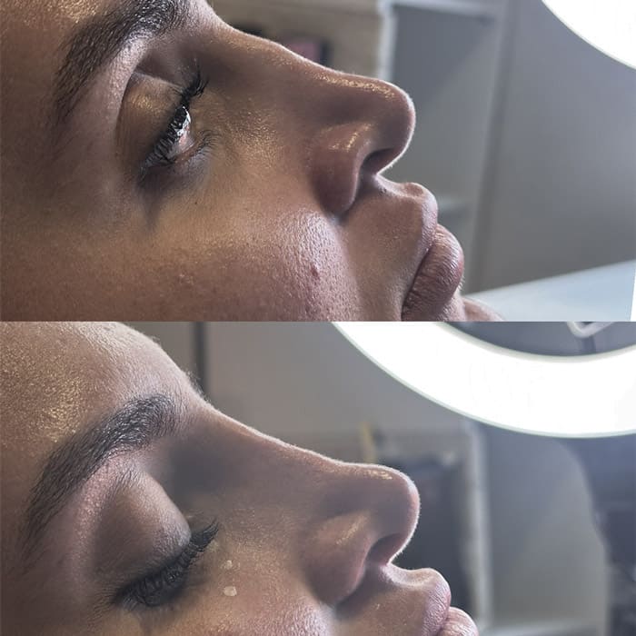 novo-resultados-dr-jhony-18