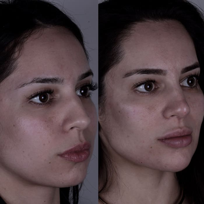 novo-resultados-dr-jhony-2