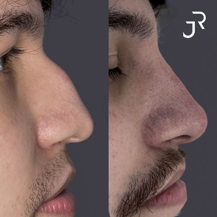 novo-resultados-dr-jhony-6