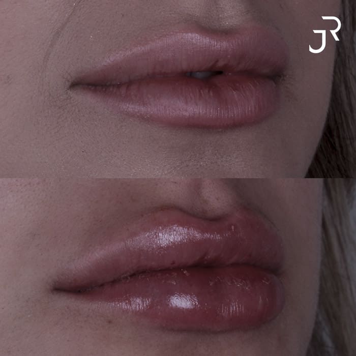 novo-resultados-dr-jhony-7