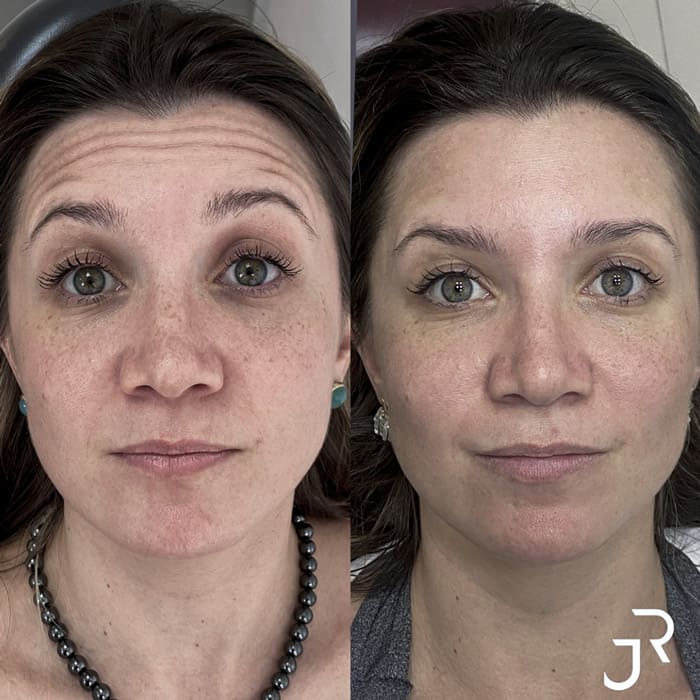 novo-resultados-dr-jhony-8