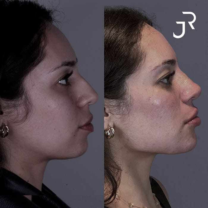 novo-resultados-dr-jhony-9